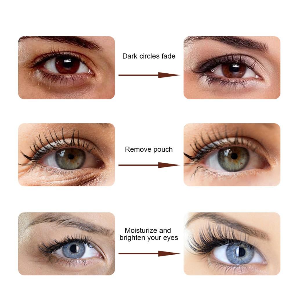 Eye Delights усиливает сыворотку, удаляет темные круги и морщины, крем для глаз, эффективный