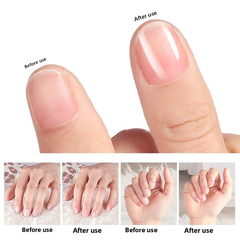 Нано-стекло Складка ногтя, Мозоли на руках и ногах, Ороговевшая кожа, Складка стопы, Подстригание ногтей, Нано-складка