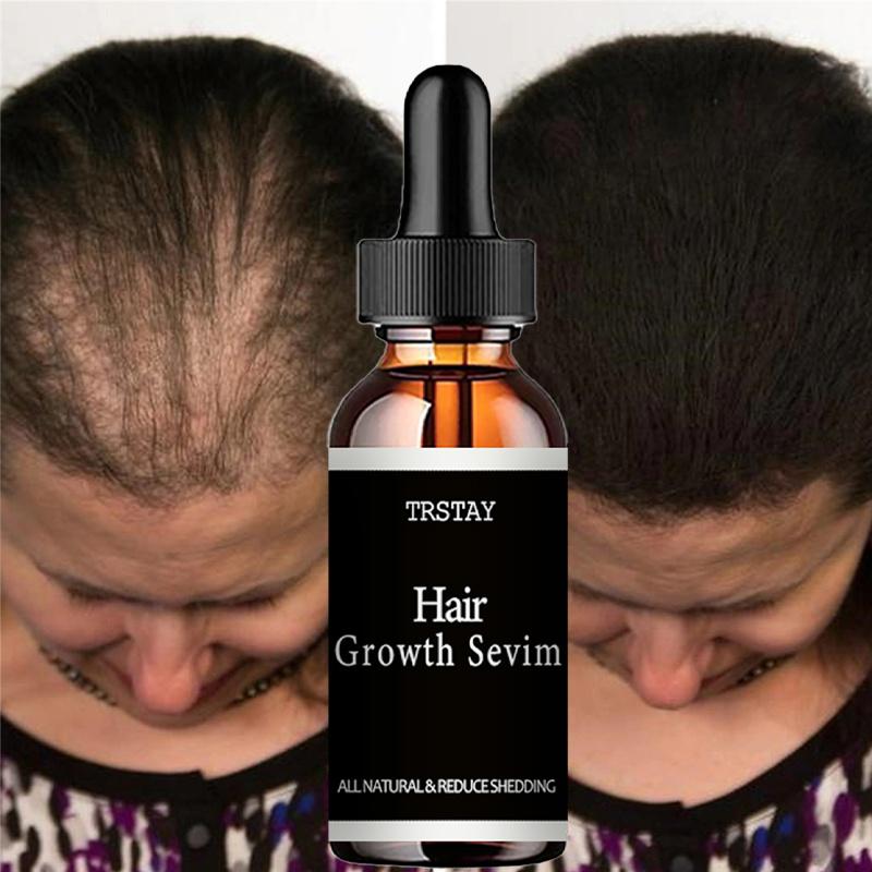 5 мл/15 мл/30 мл/50 мл/марокканское масло Эфирное масло для волос, уход за секущимися сухими и спутанными поврежденными волосами, делает волосы мягкими и блестящими