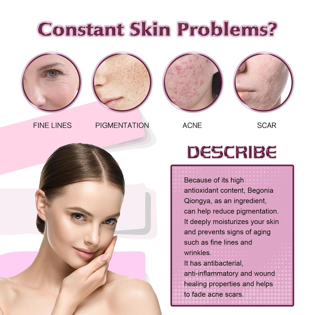 EELHOE Масло для лица «Бегония» уменьшает следы от прыщей, осветляет морщины, увлажняет и укрепляет кожу. Эфирное масло