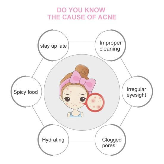 4 шт./компл. портативная игла для удаления прыщей из нержавеющей стали, косметическое средство для удаления комедонов и прыщей для носа