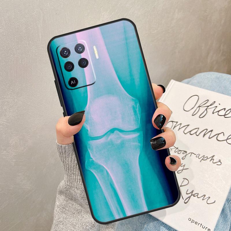 Чехол-кейс с рентгеновской анатомией человека для Oppo A40 A60 A80 A78 A38 A18 A98 A58 A96 A76 A16 A94 A74 A54 A15 A17 A57 A77 A5 Pro