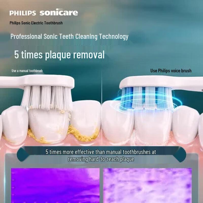Philips Звуковая электрическая зубная щетка с умной голосовой навигацией, вилка CN (адаптер в комплекте)