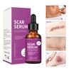 Эссенция для восстановления шрамов, уменьшающая цвет шрамов от угревой сыпи, увлажняющая сыворотка для ухода за кожей, устраняющая шрамы