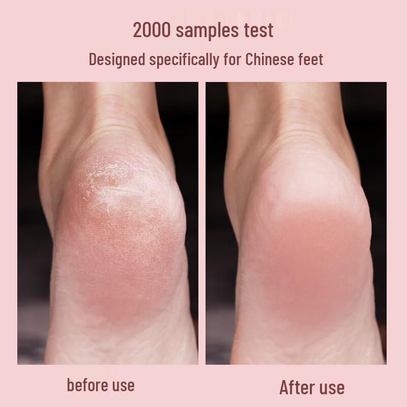 MKS Electric Rechargeable Foot File