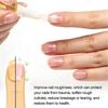 Cuticle Oil Pen for Nails  Nail Repair, Strengthening & Moisturizing Treatment with Jasmine & Olive Oil