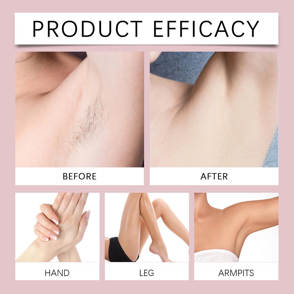 Питательный крем для удаления волос на коже всего тела, не оставляя черных точек, подмышек, рук, ног и интимных мест.