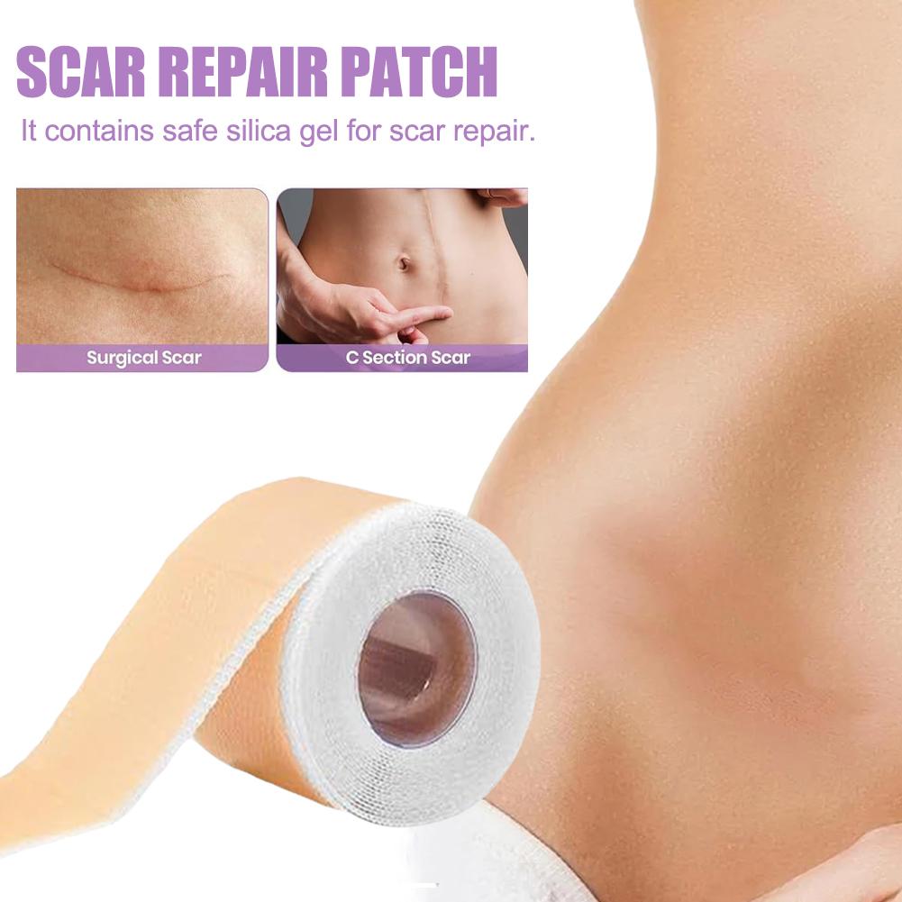 Силиконовый пластырь для шрамов, силиконовая лента для шрамов, рулон, пластырь для шрамов, пластырь для лечения акне и ожогов, пластырь для ухода за кожей Re C9M4