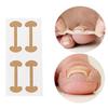4/40/200Pcs Toenail Corrector for Care Toe Nail Treatment Sticker Correction Recover Patch Foot Inserts