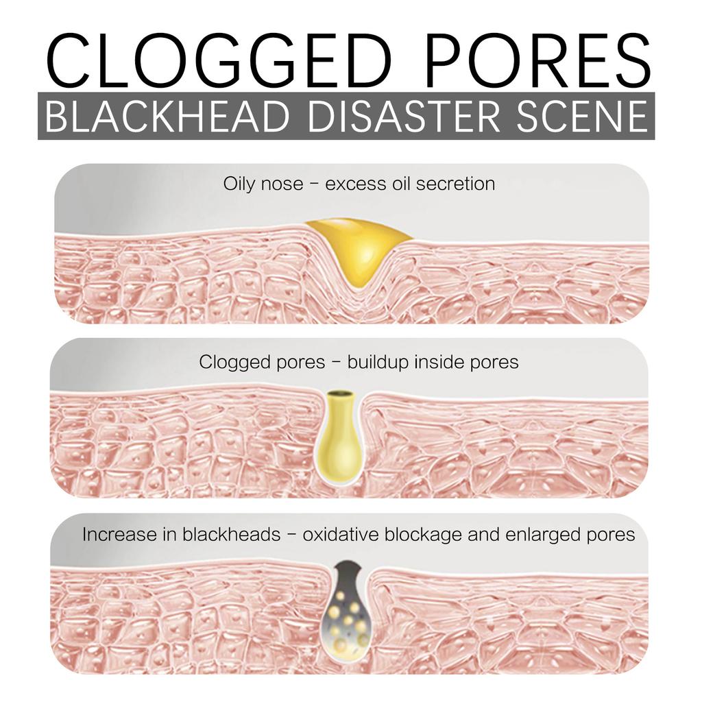 EELHOE Маска для удаления черных точек с маслом чайного дерева, черная отшелушивающая маска для лица, грязь, глубокая очистка, сужение пор, уход за кожей против прыщей, 50 г