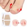 10/30/50Pcs Ingrown Toenail Toe Correction Stickers Nail Art Foot Patches Feet Care Paronychia Treatment Recover Pedicure Foot Tool