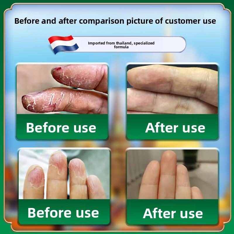 Органический травяной лосьон для сухой и потрескавшейся кожи рук и ног - Нежный уход за кожей