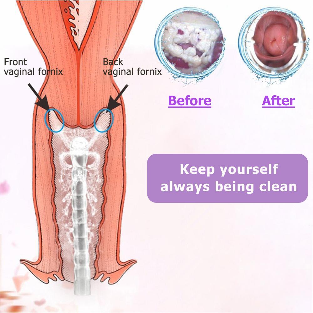 Medical Vaginal Clearner Anal Douche Enema Ass Anus Cleaning Syringe Washing Irrigator Clean Vagina Device