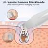 Ультразвуковой скраб для кожи, лопаточка для лица, отшелушиватель кожи лица, скребок и средство для удаления черных точек, очиститель пор, глубокое очищение лица