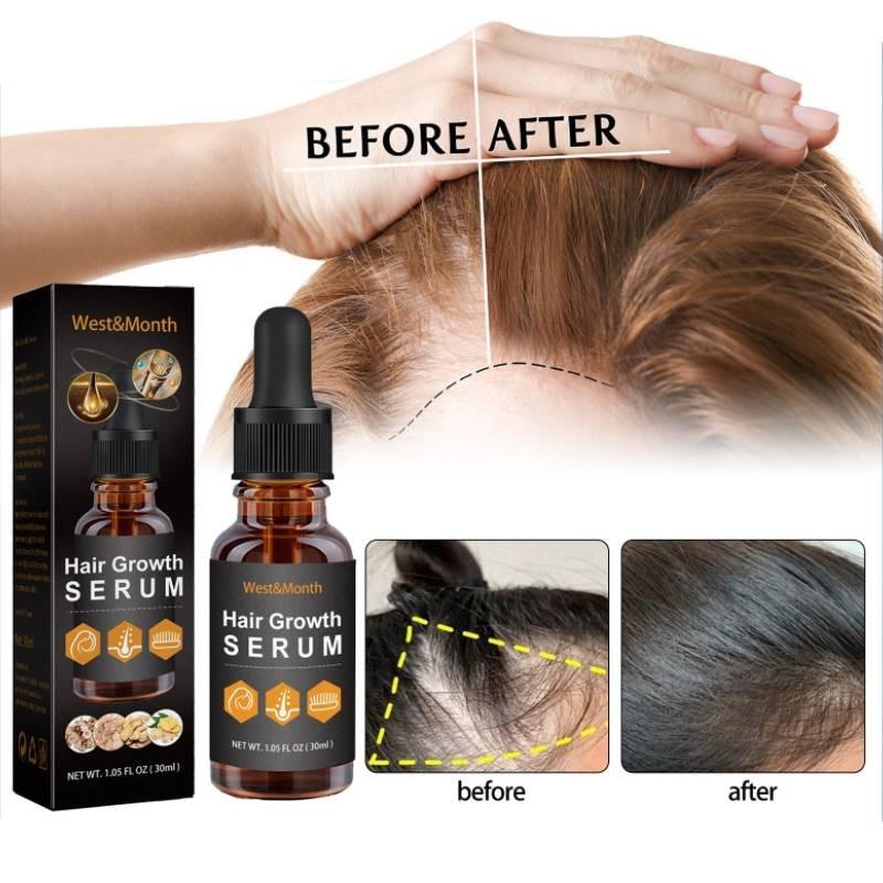 West Month Hair Growth Nutrient Oil For Lush And Thick Hair Nourishing Care 30ml
