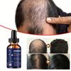 Hairloss Hair Natural Fast Growth Essential Oil Product Anti Hairloss Treatment Growth Essence Alopecia Hair Treatment for Women