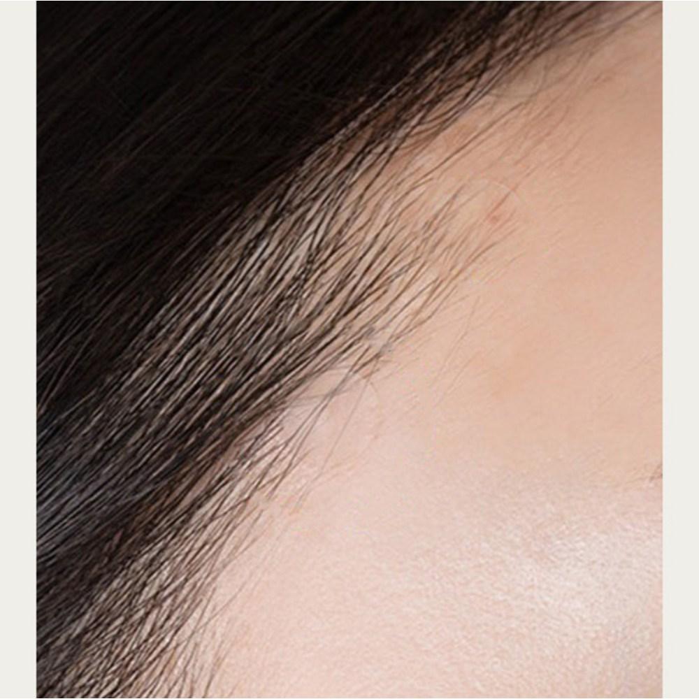 Acnes 3 Second Soothing All Clear Spot Patch 8mm X 24p + 10mm X 42p Set, 66 Sheets, 1 Piece