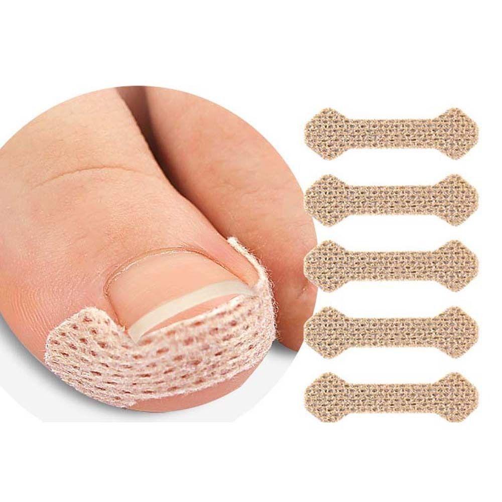 10 шт./компл. инструмент для коррекции ногтей на ногах, эластичные накладки для ухода за ногтями, брекеты для педикюра, инструменты для коррекции ногтей, наклейки