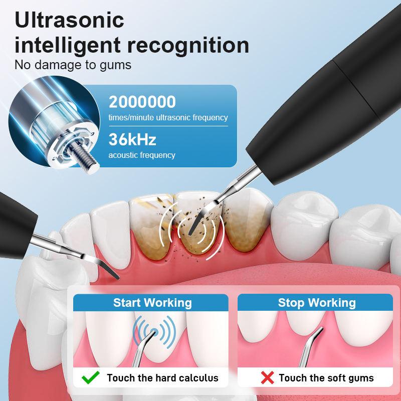 Интеллектуальный ультразвуковой очиститель зубов Стоматологический скалер 3 режима очистки Быстрая зарядка Частота 2 миллиона Удаление зубного камня Уход за деснами