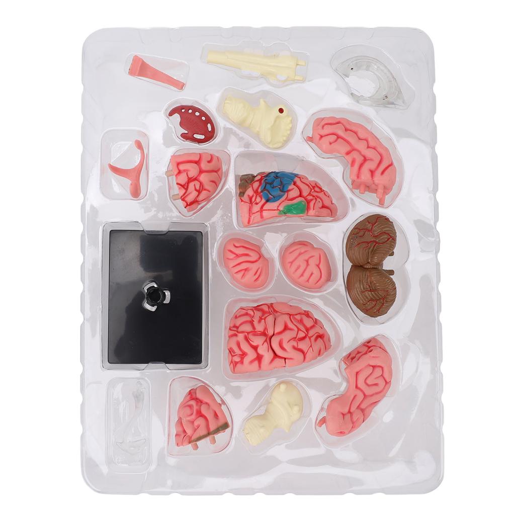 Модель мозга Нейроанатомия Структура Учебное пособие Модель анатомии человеческого мозга с основанием для образования Демонстрация