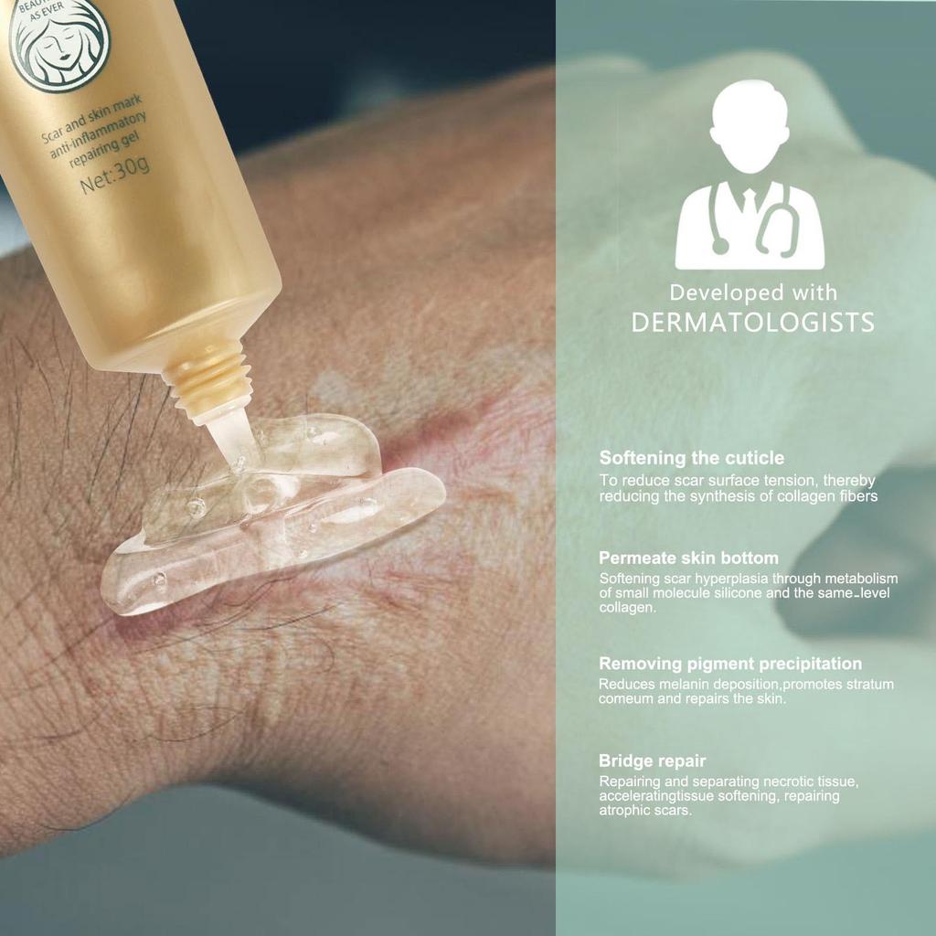 Крем от шрамов TCM, крем от угревой сыпи, шрамы от ожогов, порезы, беременность, растяжки, пятна от угревой сыпи, угри, отбеливающий крем от растяжек 30 мл)