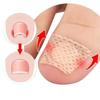 Ingrown Toenail Toe Correction Stickers Nail Art Foot Patches Feet Care Paronychia Treatment Recover Pedicure Foot Tool