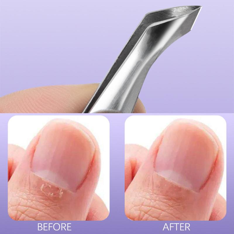 Мини-щипцы для удаления заусенцев и вросших ногтей, средство для удаления омертвевшей кожи, щипчики для ногтей, кусачки для кутикулы, кусачки для ногтей, маникюрные щипцы