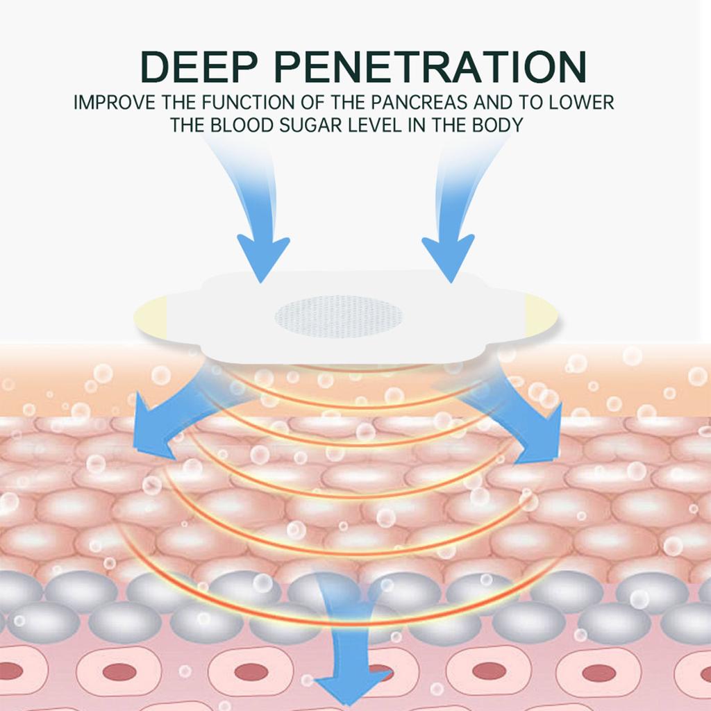 Пластырь от диабета, пластырь для здоровья, для снижения уровня сахара в крови, гипогликемический пластырь, пластырь для пупка, Ancient Light Luxury