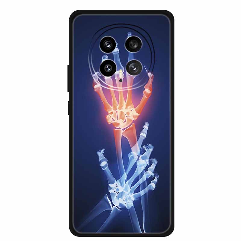 Защитный чехол для мобильного телефона For Honor Magic8 5G, с цветочным рисунком, мягкий, черный силикон, задняя крышка для Honor Magic 8 2025, чехол Funda