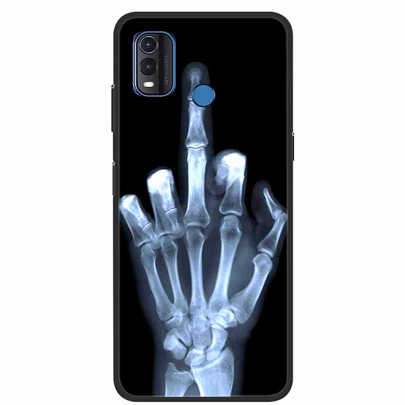 For Nokia G11 Plus Case G21 G11 C21 Plus Fashion Soft TPU Silicone Phone Case for Nokia G11 Plus Back Cover Bumper NokiaG21 Capa