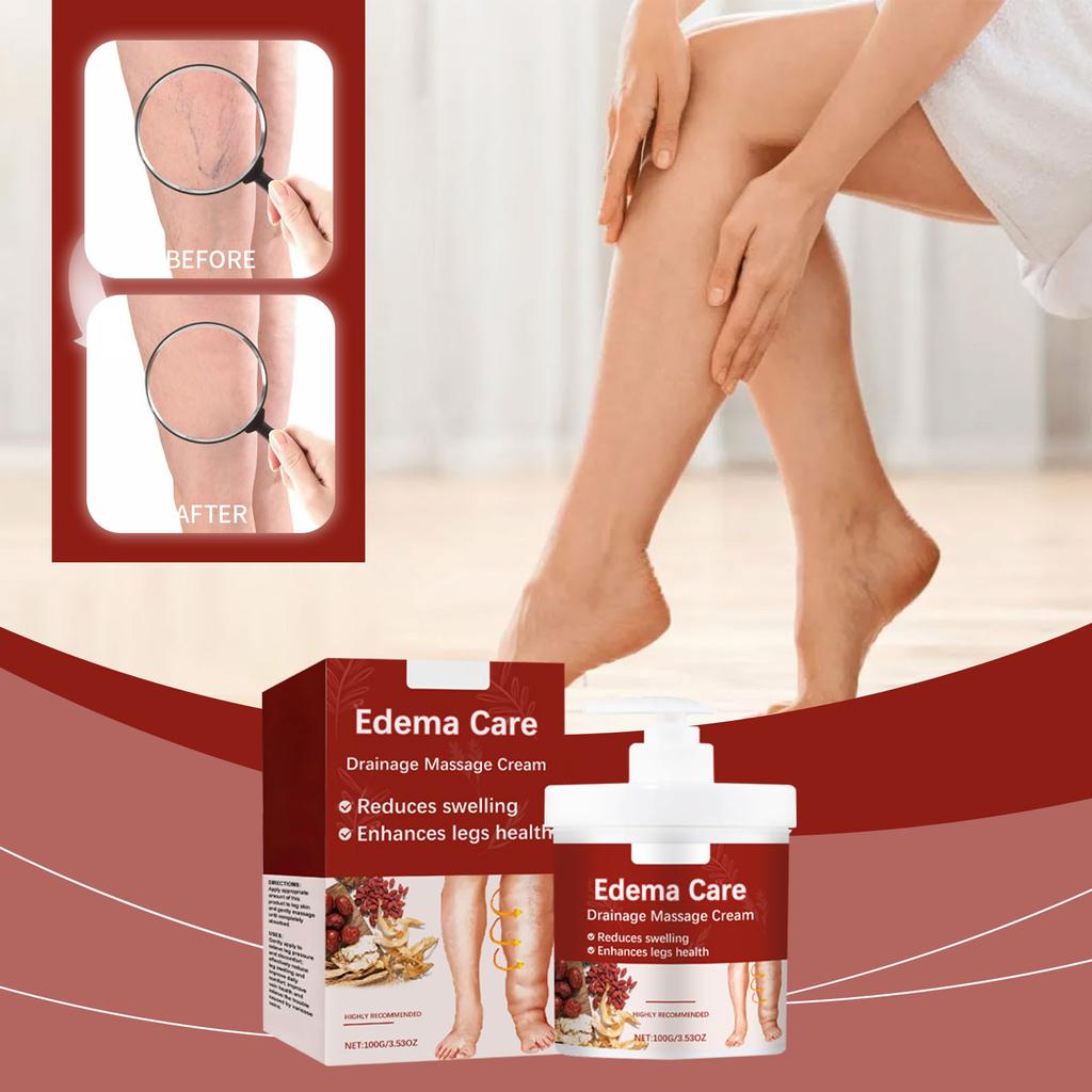 Успокаивающий крем для варикозного расширения вен. Массаж для лечения варикозного расширения вен. Уход за синими венами и красными кровяными нитями. Массаж для лечения варикозного расширения вен.