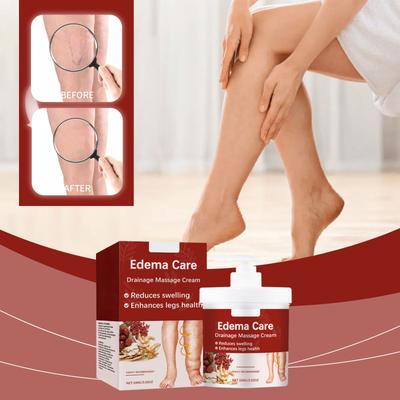 Успокаивающий крем для варикозного расширения вен. Массаж для лечения варикозного расширения вен. Уход за синими венами и красными кровяными нитями. Массаж для лечения варикозного расширения вен.