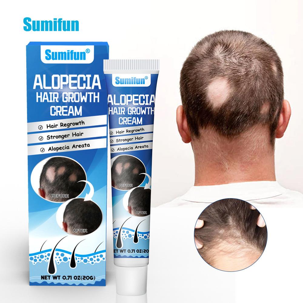 Sumifun Sophora Flavescens Balding Cream Scalp Care Hair Treatment for Men and Women Moisturizing Scalp Promote Hair Growth