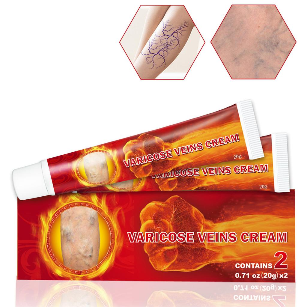 2pcs Health Cream For Relieving Varicose Veins, External Ointment For Vasculitis, Blood Circulation, Varicose Veins
