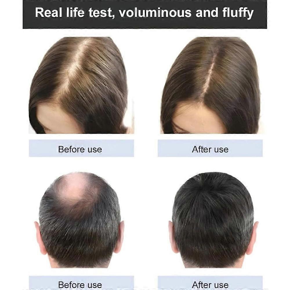 Ginger Hair Growth Essential Oils Serum Fast Hair Regrowth Anti-loss Repair Damaged Hair Strong The Root of Hair Care