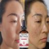 Dark Spot For Face, Dark Spot Corrector Cream, Ingredient, Enriching Skin Care For All Skin Tones, Melasma, Freckle, Sun Spot Improving