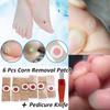 6 шт./компл. для удаления мозолей на ногах, подошвенных мозолей