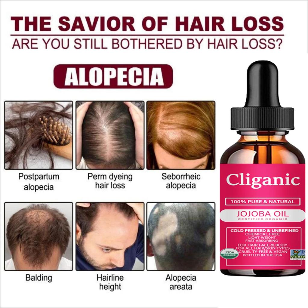 Сыворотка для роста волос, масло, быстрый густой натуральный уход за волосами, восстановление кожи головы, предотвращение выпадения волос, средства для восстановления поврежденных волос