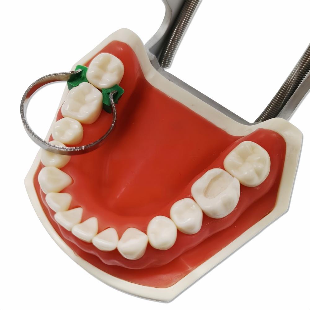 80pcs New Dental Sectional Contoured Metal Matrices Matrix Set Matrix Bands  Rubber Wedges  with Add-on Wedges Dentist Materials