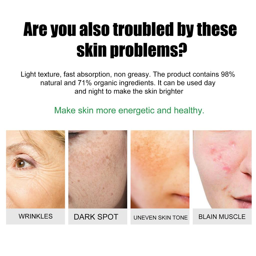 Крем для удаления прыщей и пятен Осветляет пятна Осветляет увлажняет кожу Крем для ухода и восстановления кожи от прыщей и пятен