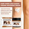 Fast Whitening Dark Knuckles Cream Pigmentation Correctors Intense Elbows Knee Skin Stains Crea T2S9