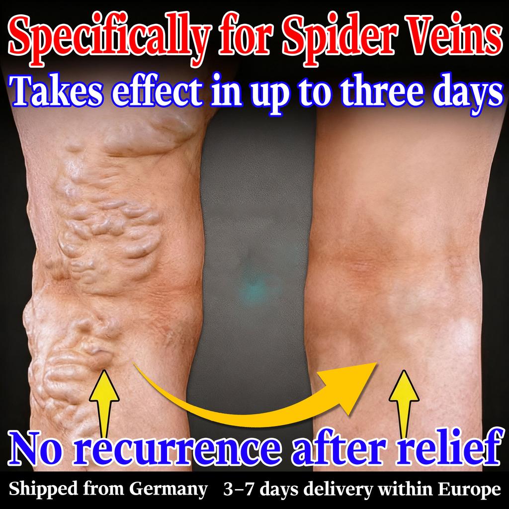 Varicose Veins Relief Cream - Natural Herbal Blend Gentle On Delicate Skin