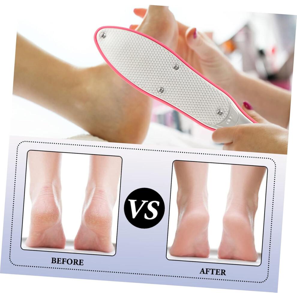 Foot File and Grinding Stone for Callus Removal Hard Skin Exfoliator Pedicure Rasp Tool