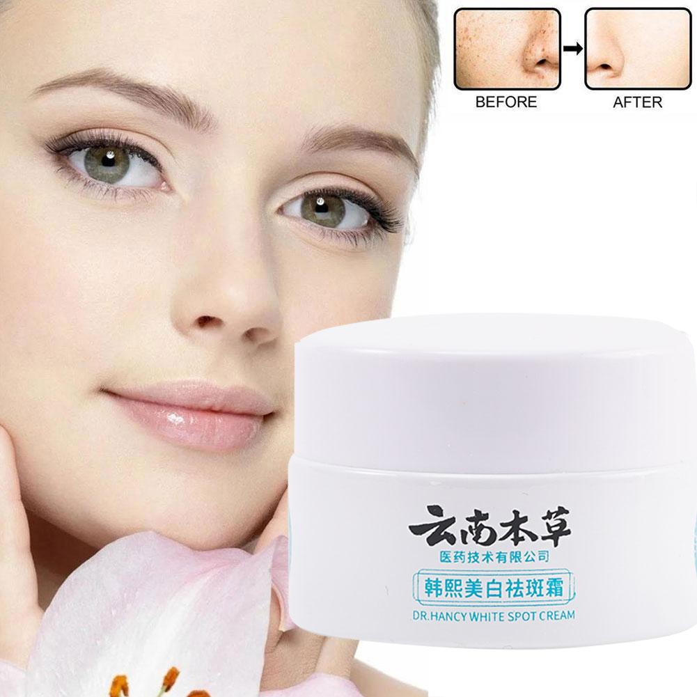 20g Powerful Yunnan Herb Whitening Freckle Cream Remove Face Face Spots Beauty Dark Acne Moistu M0T0