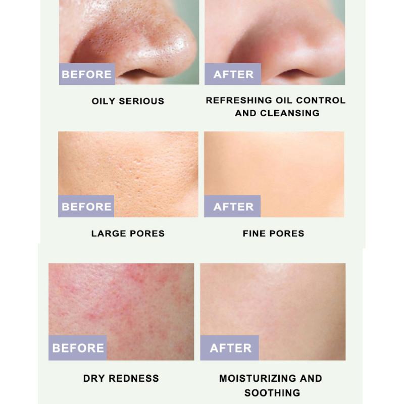 Маска для лица очищающая стик-маска с зеленым чаем сужает поры глубоко удаляет черные точки очищающая увлажняющая маска для лица 40 г