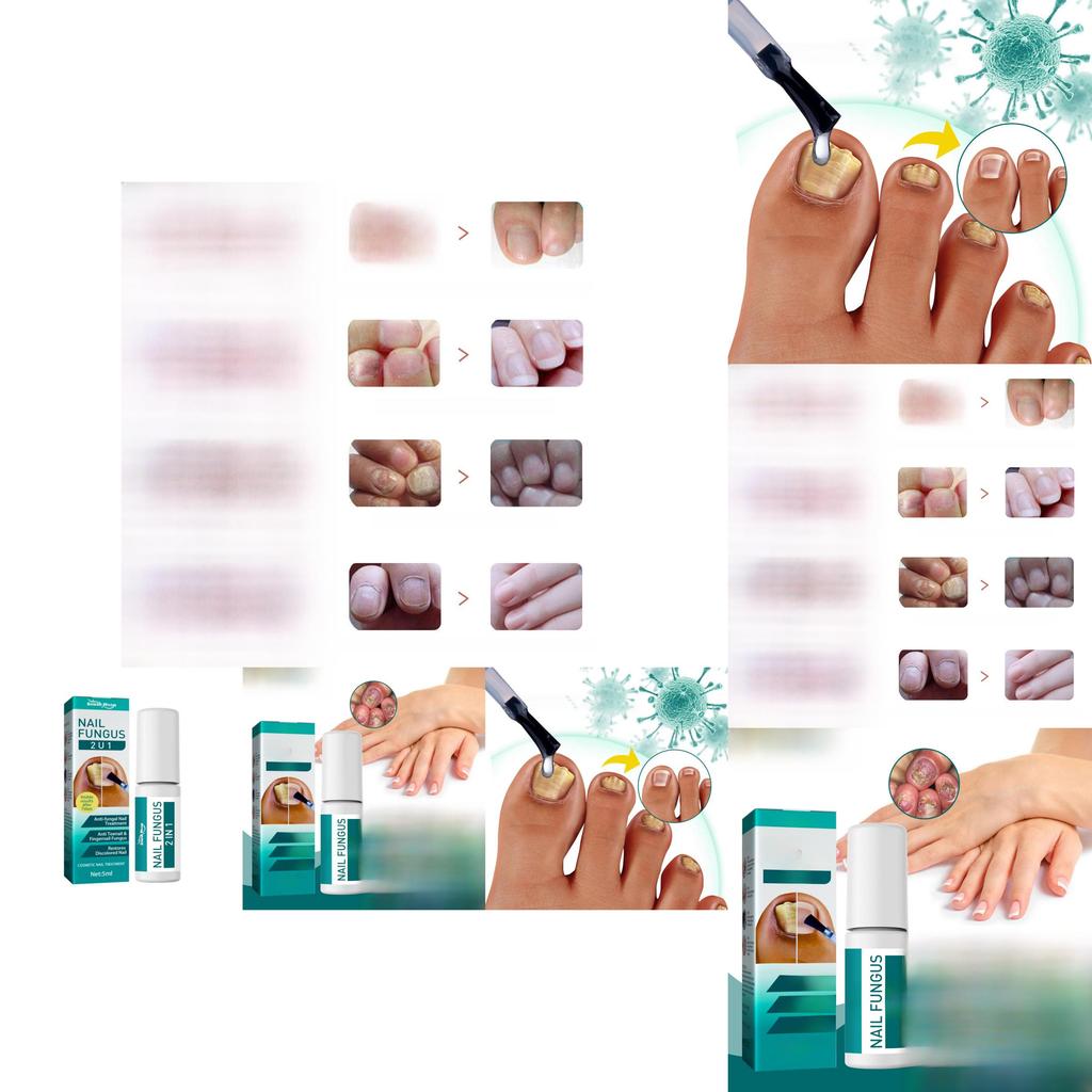 Премиальное средство для восстановления ногтей на ногах 5 мл Для обесцвеченных ногтей и смягчения ногтей