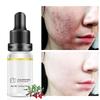 Moisturizing Face Serum Whitening Skin Care Anti Aging Anti Wrinkle Cream 10ml