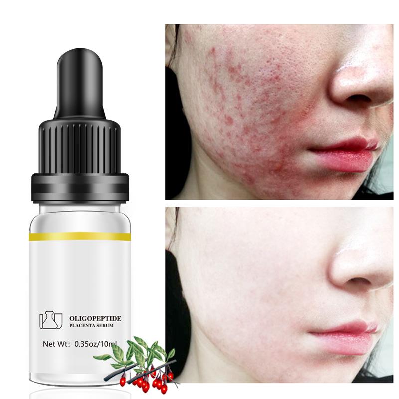 Moisturizing Face Serum Whitening Skin Care Anti Aging Anti Wrinkle Cream 10ml