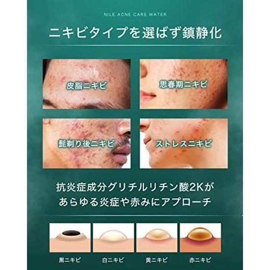 NILE Acne Lotion Mens Womens Quasi-Drug (EUCALYPTUS MINT scent)