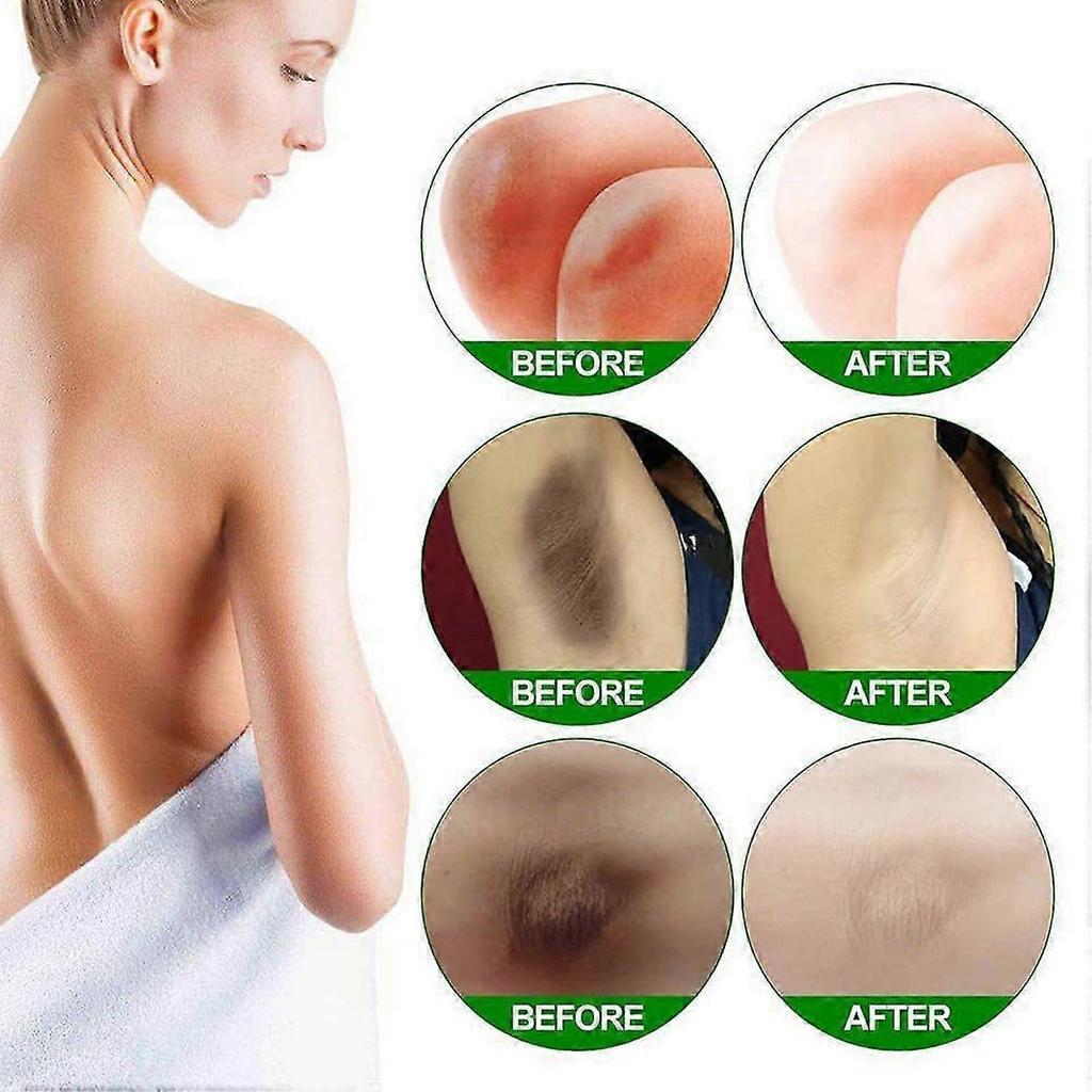 Underarm Brightening Cream for Dark Armpits, Elbows & Knees